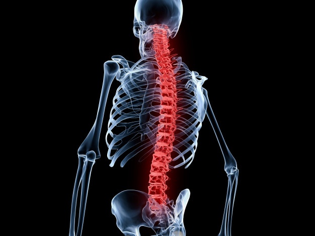 احجز الأن عملية تصحيح تشوهات العمود الفقري تدخل جراحي يمنحك حياة مستقيمة بدون ألم