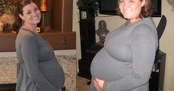  هل يزيد الوزن في الحمل بعد التكميم